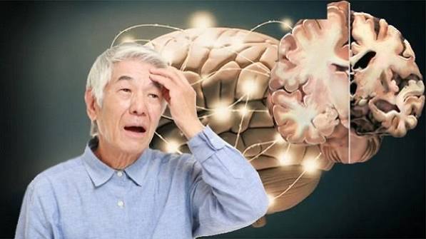 Nghiên cứu tiềm năng ức chế acetylcholinesterase của các dẫn xuất tranilast bằng phương pháp in vitro và in silico