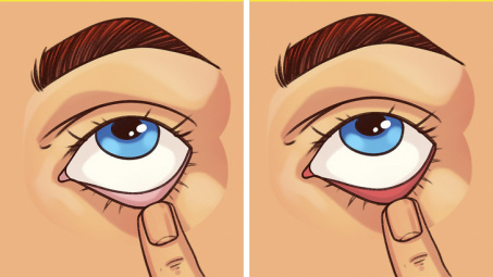 9 bước kiểm tra sức khoẻ đơn giản, phát hiện bệnh sớm mà bạn có thể thực hiện ngay tại nhà