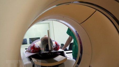 Bộ Y tế kết luận về sử dụng trí tuệ nhân tạo trong điều trị ung thư