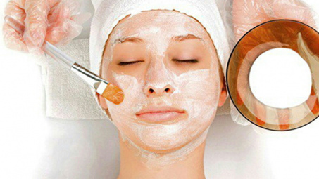 Cách trị nám da tại nhà từ nguyên liệu thiên nhiên