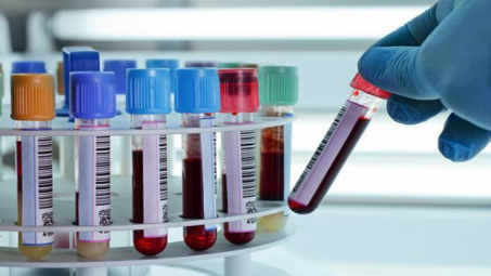 Phụ nữ khám sức khỏe tổng quát cần kiểm tra những gì?