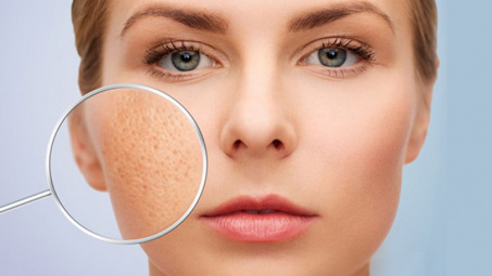 Vì sao có tình trạng lỗ chân lông to?