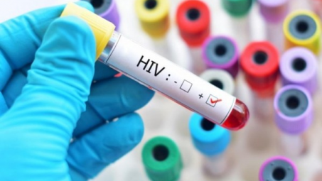 Lạng Sơn: Tăng cường phòng chống HIV/AIDS trong bối cảnh dịch bệnh Covid-19