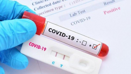 Khuyến cáo người tiêu dùng khi mua kit test nhanh Covid-19