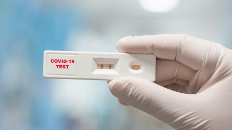 Loạn giá kit test Covid-19, Quản lý thị trường vào cuộc kiểm tra