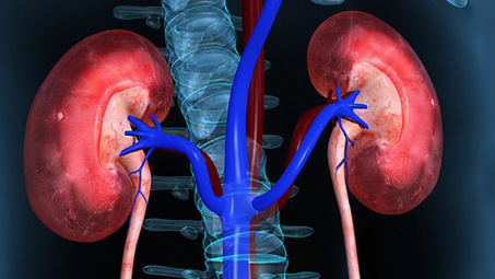 Tổn thương thận vì những thói quen hàng ngày