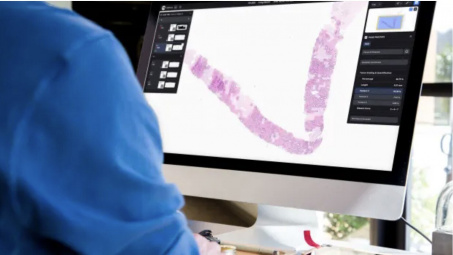 Microsoft và Paige “bắt tay” xây dựng mô hình AI lớn nhất thế giới để phát hiện ung thư