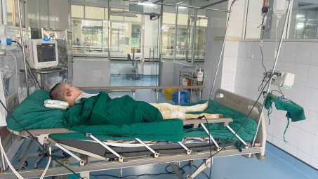 Công đoàn Tổng công ty Giấy kêu gọi quyên góp cho mẹ đơn thân bị bỏng nặng nguy kịch