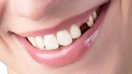 Thiết bị mô phỏng vận động nhai của hàm răng