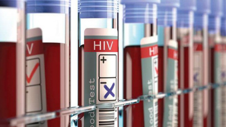 Xuất hiện bệnh nhân thứ 3 trên thế giới được chữa khỏi HIV