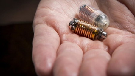 "Du ngoạn" trong hệ tiêu hoá