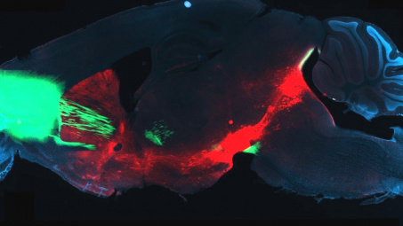 Phương pháp mới: Cai nghiện ma túy ngay từ trong não