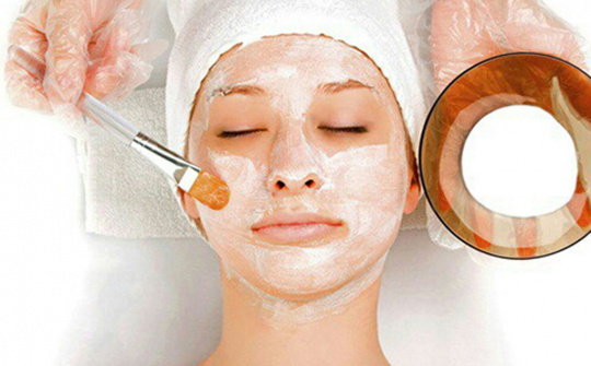 Cách trị nám da tại nhà từ nguyên liệu thiên nhiên