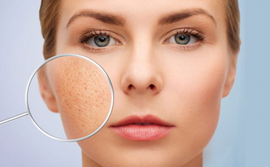 Vì sao có tình trạng lỗ chân lông to?