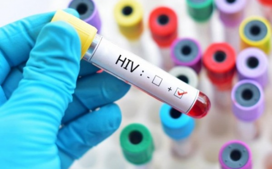 Lạng Sơn: Tăng cường phòng chống HIV/AIDS trong bối cảnh dịch bệnh Covid-19