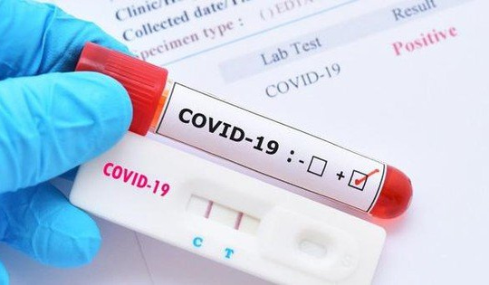 Khuyến cáo người tiêu dùng khi mua kit test nhanh Covid-19