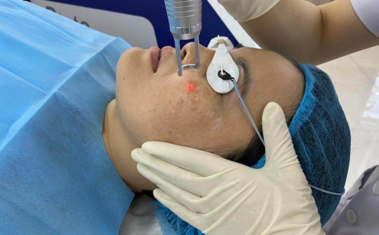 Top 5 công nghệ trị nám hiệu quả nhất hiện nay