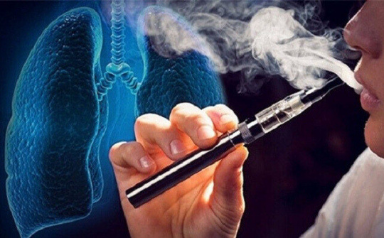 Cân nhắc áp dụng thuế tiêu thụ đặc biệt đối với Thuốc lá mới