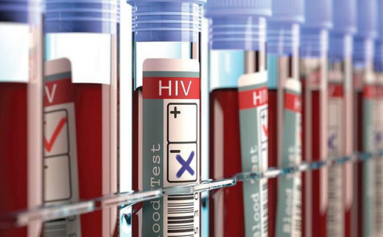 Xuất hiện bệnh nhân thứ 3 trên thế giới được chữa khỏi HIV