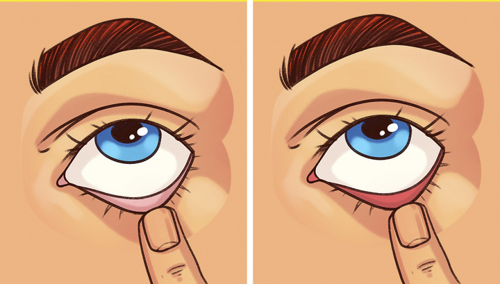 9 bước kiểm tra sức khoẻ đơn giản, phát hiện bệnh sớm mà bạn có thể thực hiện ngay tại nhà