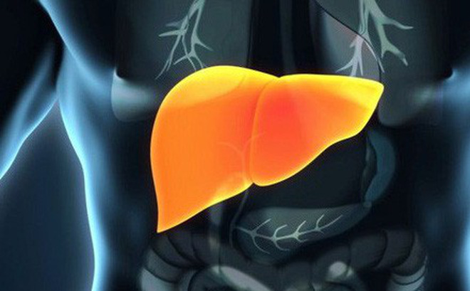 Không chỉ uống rượu, ăn chất béo cũng bị gan nhiễm mỡ