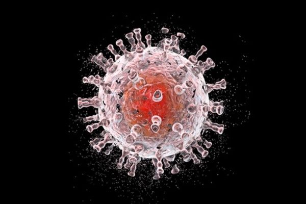 10 dấu hiệu ung thư da bạn cần phát hiện sớm