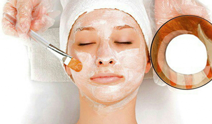 Cách trị nám da tại nhà từ nguyên liệu thiên nhiên