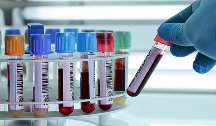 Phụ nữ khám sức khỏe tổng quát cần kiểm tra những gì?