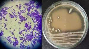 Tuyển chọn chủng vi khuẩn lactic có khả năng sinh tổng hợp enzim glutamatedecarboxylaza hoạt lực cao nhằm sử dụng lên men chè đen thu sản phẩm giàu gama aminobutyric axit (GABA)