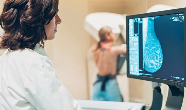 Khoa học Mỹ dùng AI tiên đoán chính xác thời gian sống sót của bệnh nhân ung thư