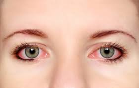 6 điều tuyệt đối không nên làm khi đau mắt đỏ