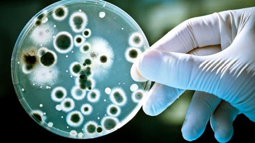 Developing gold nanoparticle-based biosensors for simple and fast detection of Staphylococcus aureus