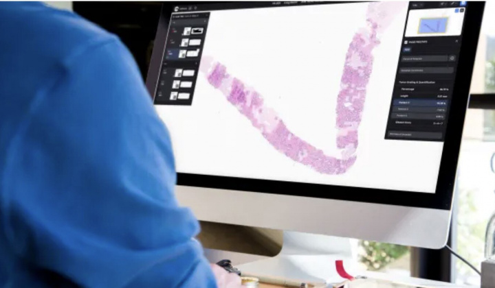 Microsoft và Paige “bắt tay” xây dựng mô hình AI lớn nhất thế giới để phát hiện ung thư