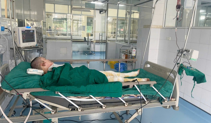 Công đoàn Tổng công ty Giấy kêu gọi quyên góp cho mẹ đơn thân bị bỏng nặng nguy kịch