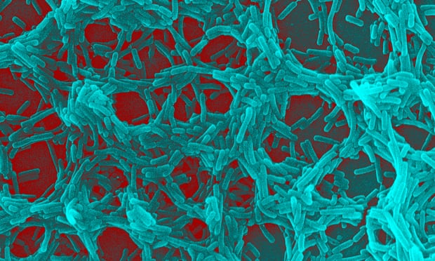 Vi khuẩn đường ruột cũng là nguyên nhân gây trầm cảm