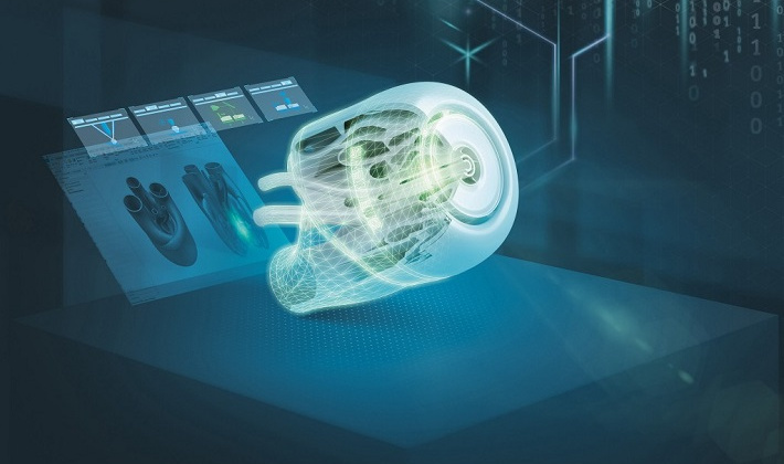 Đối phó với COVID -19, Tập đoàn Siemens tăng cường công nghệ thúc đẩy thiết kế, sản xuất các thiết bị y tế