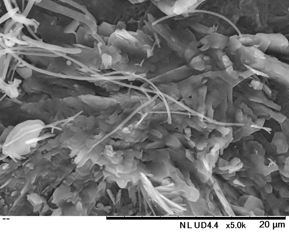 A close-up of a microscope

Description automatically generated