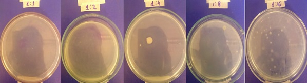 Vibrio Parahaemolyticus